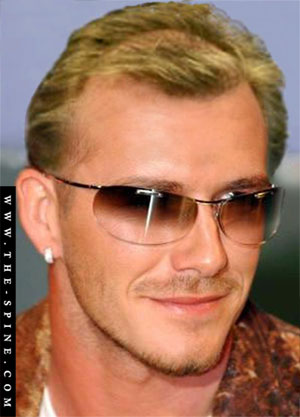 Beckham Hair Loss