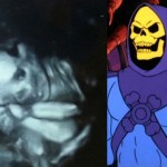Ultrasound horrors: these human embryos look familiar