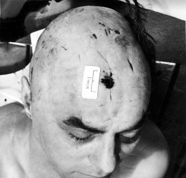 A police photograph of a very dead George Cornell. Kirsty Wigglesworth/PA Archive/Press Association Images