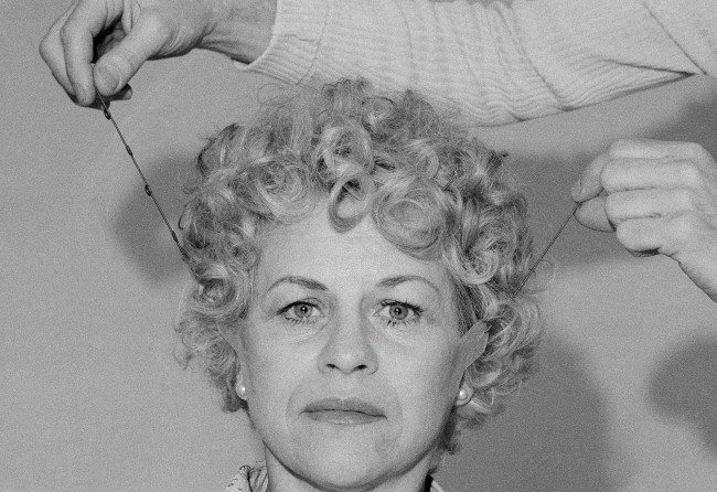 Joanne Viggiano is the model for a temporary face lift by Mark Traynor at his studios in New York on Friday, March 11, 1977. The ÂliftÂ a combination of tape and elastic cord is placed at three areas of the face - the upper forehead, in front of the ears and at the neck. 