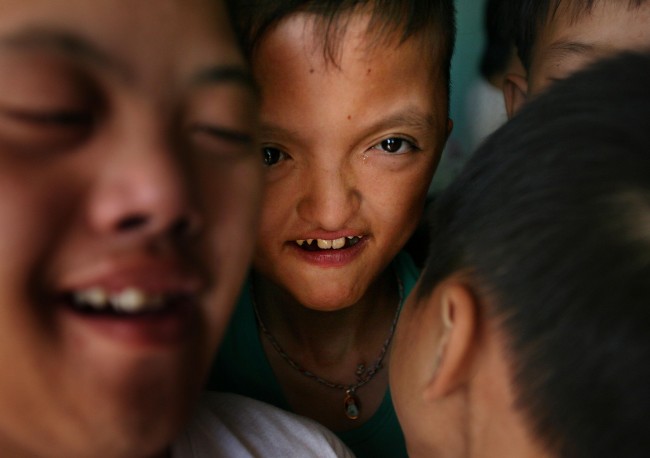 *A group of boys play together at a center for Agent Orange victims in Danang, Vietnam, in this May 21, 2007, file photo. More than 30 years after the Vietnam War ended, the poisonous legacy of Agent Orange has emerged anew with a scientific study that has found extraordinarily high levels of health-threatening contamination at the former U.S. air base at Danang. 