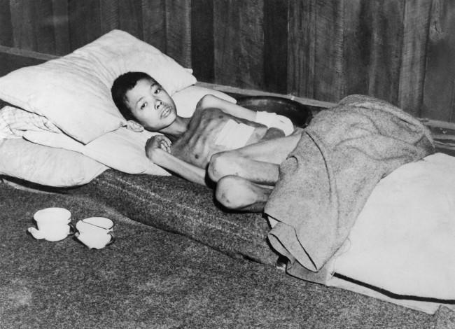 A 12 year old Burmese boy, Aung Thei was beaten by Japanese with shovels and rifle butts suffered 4, bayonet wounds, Feb. 26, 1945. He was buried alive in a shallow grave but he managed to crawl out. He made his way to a Basha where he was found by a patrol of the Royal Scots Fusiliers, 36th division. The lad of being treated by the Field Ambulance Company. In addition to multiple bayonet wounds in the chest, back and a below he is suffering from dysentery and malaria, is recovery is expected. 