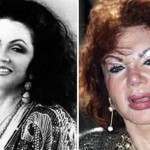 Jackie Stallone’s Changing Face