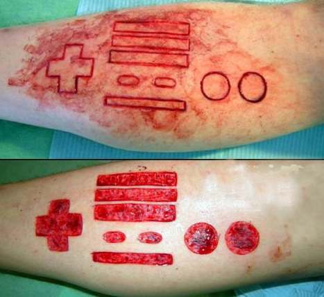  cut himself a Nintendo controller in one of his arms. Why?