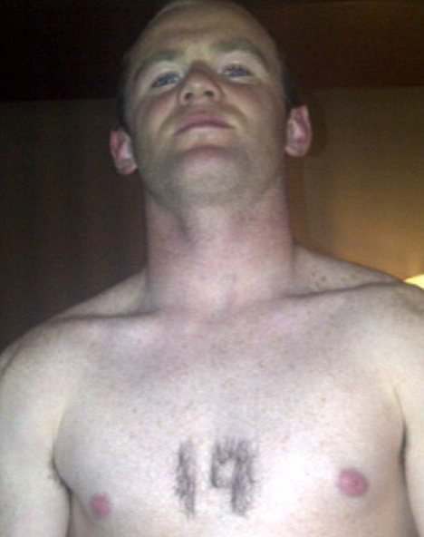 Anorak News | Wayne Rooney's Hair Transplanted From His Chest And Women's  Pillows? Photo