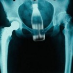 X-Rays: The Weirdest Internal Photos Ever