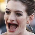 Actresses without teeth