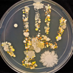 Bacteria-infested handprints produced by an 8-year-old playing outside