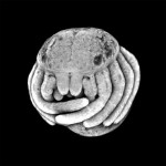 Baby spider embryo’s are adorable (photo)